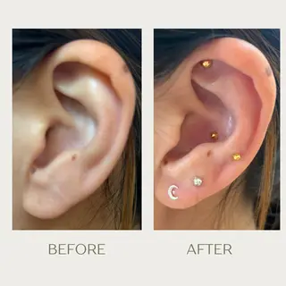 ピーリングケア 🤍moekoのエステ・リラクイメージ