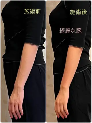 Anne’s happyBonesのエステ・リラクイメージ