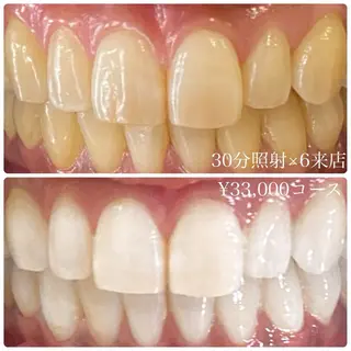 PLATINUM Beauty 横浜店所属・ホワイトニングルーム 横浜店のその他イメージ