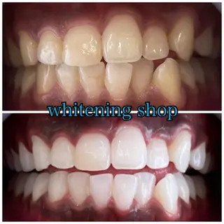 メンズ ホワイトニング ショップ川越店のエステ・リラクイメージ