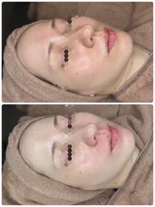 EstheticSalonReTweet所属・竹谷 春希のエステ・リラクイメージ