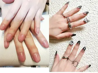 セミロング ネイル フィルイン、長さ出し 深爪矯正のネイルデザイン