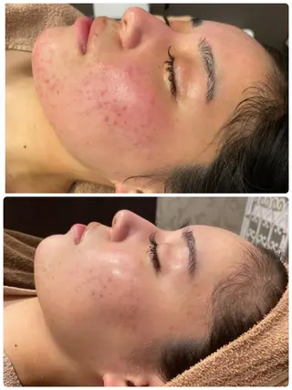 RAYVIS梅田店 FUJIのエステ・リラクイメージ