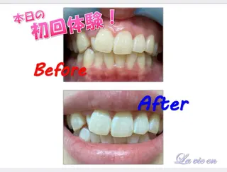 セルフホワイトニングサロン　ラヴィアン所属・ホワイトニングサロン La vie enのその他イメージ