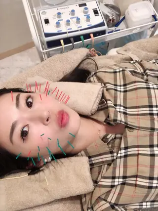 鍼灸整骨院Refine所属・鍼灸 Refineのその他イメージ