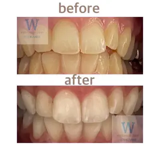 ホワイトニング ショップ本八幡店のエステ・リラクイメージ