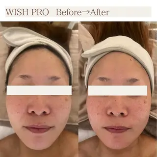 Total Beauty salon Bloom所属・肌育WISHpro 専門サロンBloomのエステ・リラクイメージ