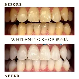 メンズ ホワイトニング ショップ葛西店のその他イメージ