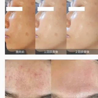 ネイルサロンBONICA所属・韓国ネイルエステ💅 bonicaMANAのエステ・リラクイメージ