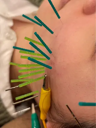 Hari Lounge恵比寿所属・chika🦋 ハリラウンジ恵比寿のエステ・リラクイメージ