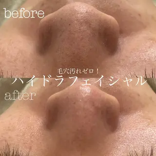 フェイシャルサロン CHIARA 荒田のエステ・リラクイメージ