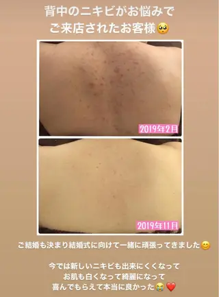 ミディアム カラー パーマ ヘアアレンジ メンズ キッズ ネイル マツエク・マツパ ニキビ・肌質改善専門 ♡人生が変わるサロンのエステ・リラクイメージ