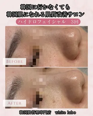 韓国肌管理専門店　White labo 梅田店所属・大西 亜季のエステ・リラクイメージ