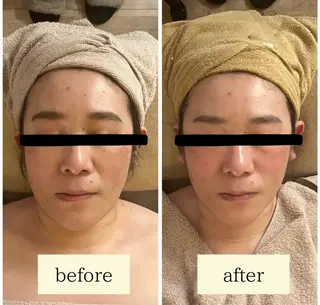 コルギ＆リラクゼーション　Acorde所属・小顔・巻肩・猫背ケア コルギ　Acordeのエステ・リラクイメージ