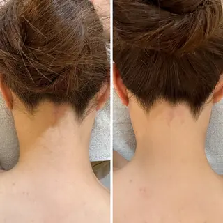 うなじ脱毛/美肌脱毛 LABELのエステ・リラクイメージ