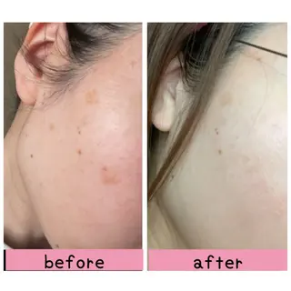 毛穴・リンパ・肌ケア サロン スリールのエステ・リラクイメージ