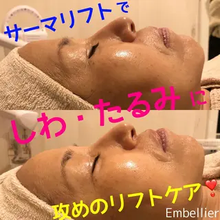 Embellier所属・Embellier ★のエステ・リラクイメージ