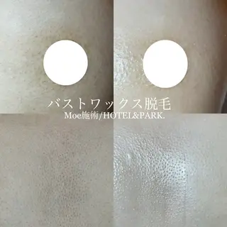 HOTEL&PARK .Moeワックス脱毛のエステ・リラクイメージ