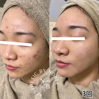 NOBLE 新宿南口店のエステ・リラクイメージ