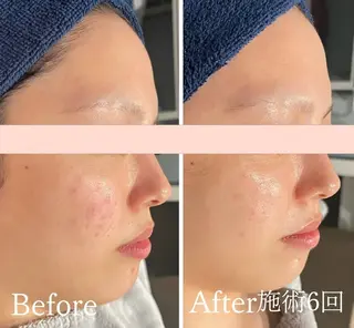 アンド ミルルのエステ・リラクイメージ