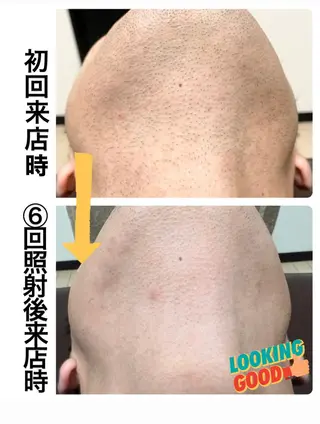 メンズ メンズ脱毛サロン Le falcoのエステ・リラクイメージ