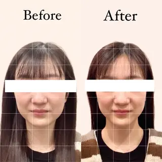 Hari Lounge恵比寿所属・chika🦋 ハリラウンジ恵比寿のエステ・リラクイメージ