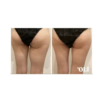 'OLI yukinaのエステ・リラクイメージ