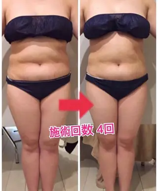 ロング カラー パーマ ヘアアレンジ メンズ キッズ ネイル マツエク・マツパ ‍痩身＆ボディ 結果出し🌟丹野のエステ・リラクイメージ