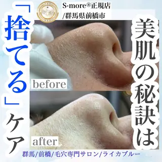 毛穴専門サロン ライカブルーのエステ・リラクイメージ