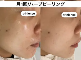TRINIENCE 南流山店のエステ・リラクイメージ