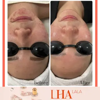 Liam《美肌管理/ 3D小顔/脂肪ケア》のエステ・リラクイメージ