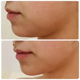 ICHOOSE/ 代々木上原のエステ・リラクイメージ