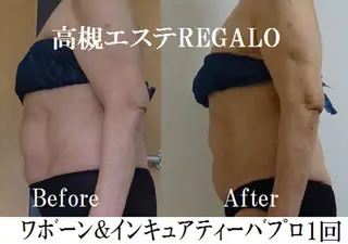 REGALO所属・矢野 さやかのエステ・リラクイメージ