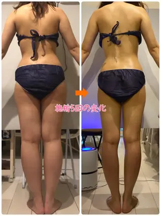 ショート カラー パーマ ヘアアレンジ メンズ キッズ ネイル マツエク・マツパ ‍痩身＆ボディ 結果出し🌟丹野のエステ・リラクイメージ