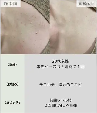 脱毛・眉毛・フェイス サロンN久留米店の眉毛・アイブロウイメージ