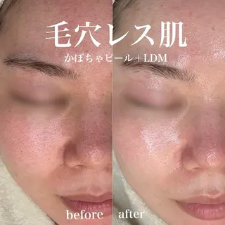 韓国肌管理&小顔 ＩＲＯＨＡのエステ・リラクイメージ