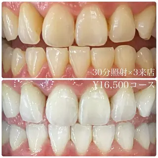 PLATINUM Beauty 横浜店所属・ホワイトニングルーム 横浜店のその他イメージ