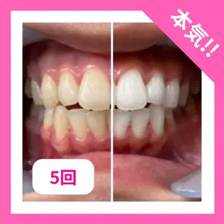 お肌と歯のサロン　Sona Mior所属・藤井 ののみのエステ・リラクイメージ