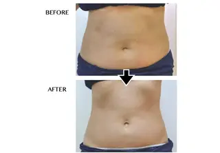 LAGRECE 大阪梅田店のエステ・リラクイメージ