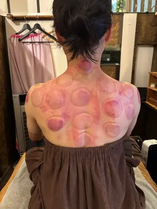 かっさ(刮痧)専門店 心氣院のその他イメージ