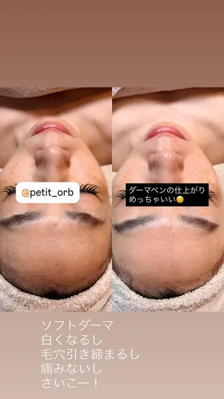 petit Orb所属・petit Orb 大谷梨紗のエステ・リラクイメージ