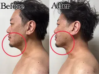 六本木脱毛andS さおりのエステ・リラクイメージ