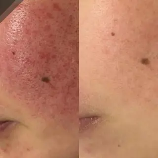 ニキビ・肌質改善専門 ♡人生が変わるサロンのエステ・リラクイメージ