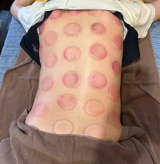 鍼灸院楽々館所属・宇田 碧のエステ・リラクイメージ