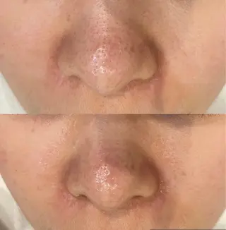 DeI'm   名古屋栄所属・小林 玲菜のエステ・リラクイメージ