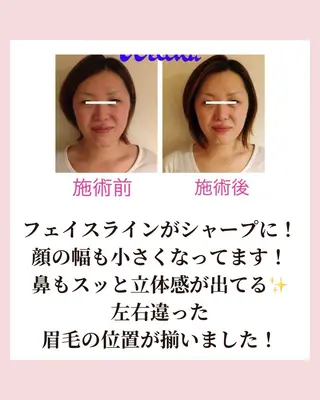 痩身・小顔・骨盤矯正×ヒップアップ専門エステ Peach所属・桃尻つかさ🍑小顔× ノーファンデ肌作りのエステ・リラクイメージ