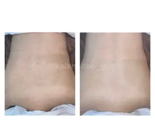 肌質改善 KALANCHOEのエステ・リラクイメージ