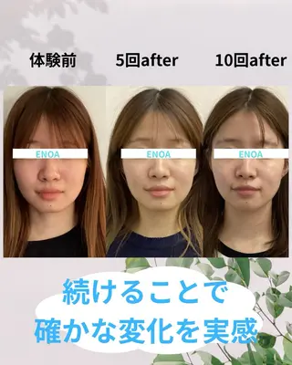 ENOA所属・コルギ/全身リンパ saoriのエステ・リラクイメージ