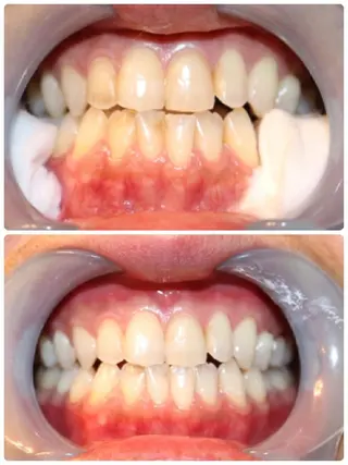 ラ シュシュのマツエク・マツパデザイン