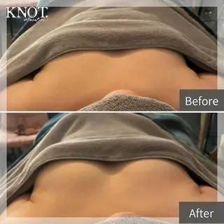 KNOT.relaxation所属・KNOT. Chiz.のエステ・リラクイメージ